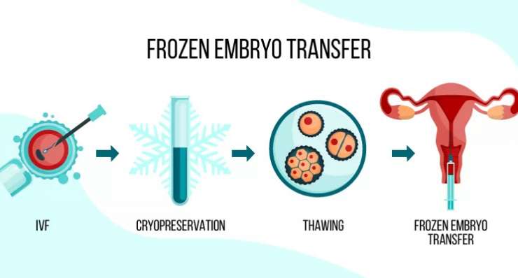 Frozen Embryo Transfer (FET)