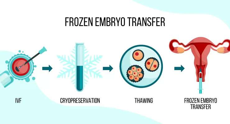 Frozen Embryo Transfer (FET)