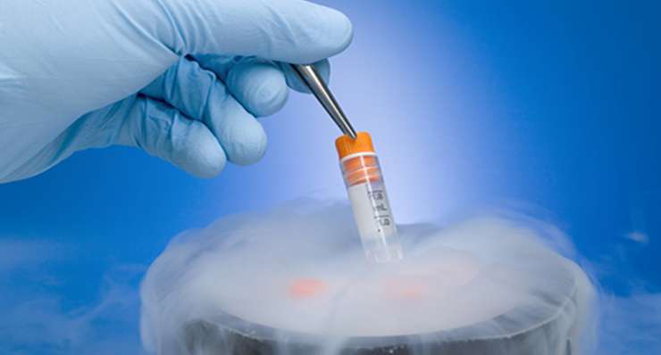 Egg Freezing