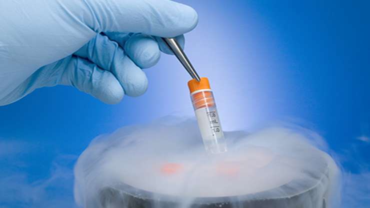 Egg Freezing