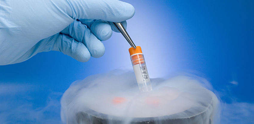 Egg Freezing