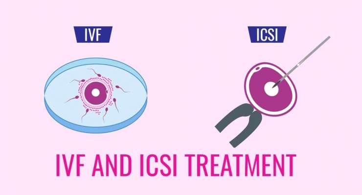 IVF/ICSI
