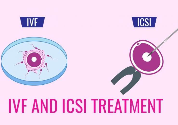 IVF/ICSI