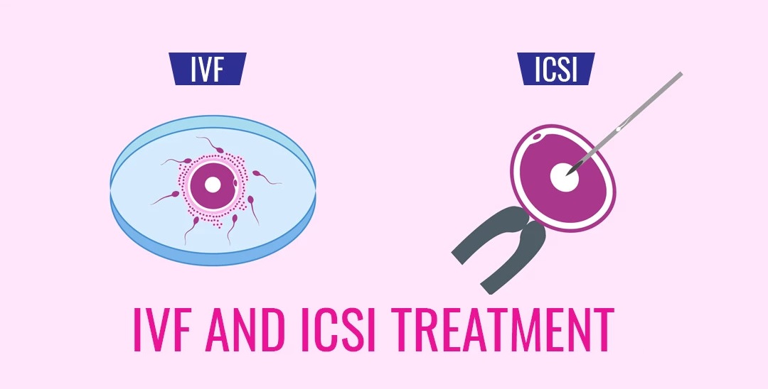 IVF/ICSI